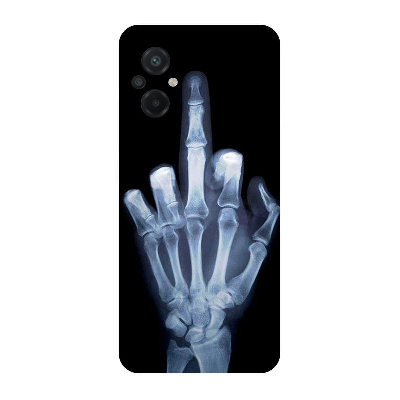 Poco M5 2022 4G için kılıf fut - Phone Cases Liverpool incelemesi ve fiyatı